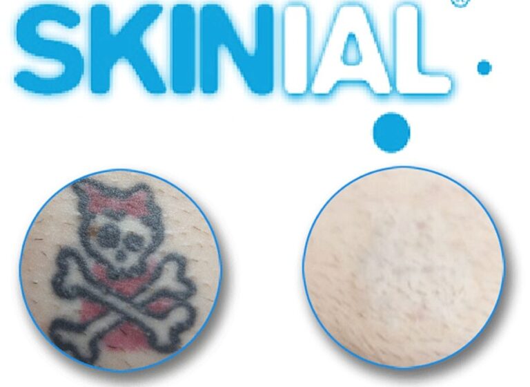 skinial